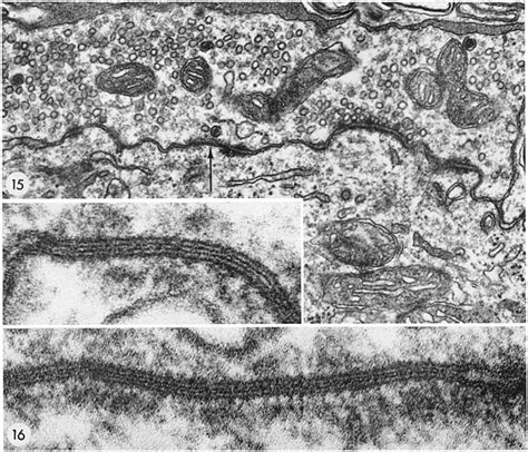 The presynaptic (above) and postsynaptic (below) membrane of certain... | Download Scientific ...