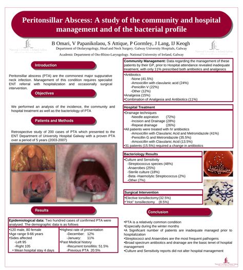 Peritonsillar Abscess Drainage