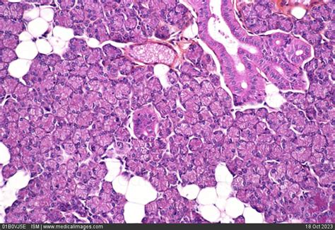 STOCK IMAGE, photomicrograph of a normal parotid gland histological ...