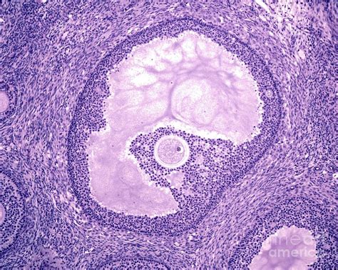 Graafian Follicle Histology