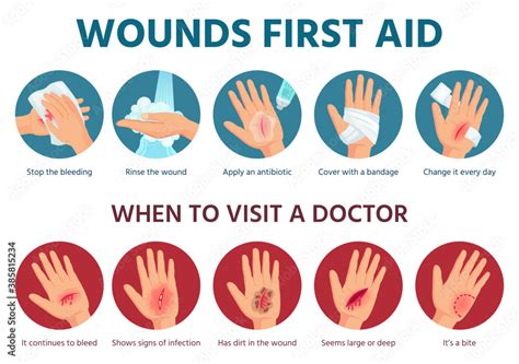 First aid for wound on skin. Treatment procedure for bleeding cut. Bandage on injured palm ...