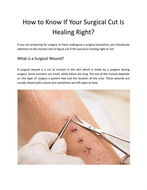 PPT - How to Know If Your Surgical Cut Is Healing Right? PowerPoint ...