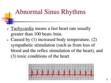 PPT - Electrocardiography – Abnormalities (Arrhythmias) 7 PowerPoint ...