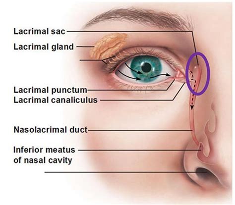 Lacrimal Punctum Swollen