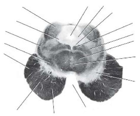 Posterior view of the brainstem showing the two superior and two ...