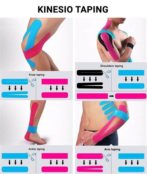 Kinesio Taping & Therapeutic Taping - Physical Therapists NYC