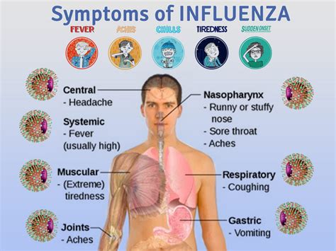 Flu Symptoms 2024 Adults Today 2024 Cdc - Shea Willie