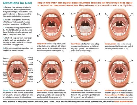 How to tell if my child has a sore throat - Lovebugs and Postcards