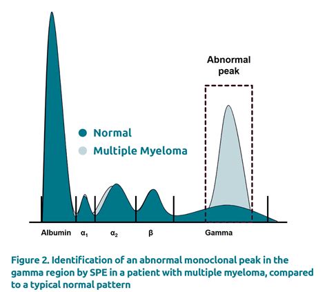 Two common peak-integration protocols for the quantification of M ...