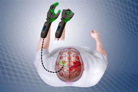 Neuroprosthetics — A Simple Guide from a Neuroscience Student | by ...