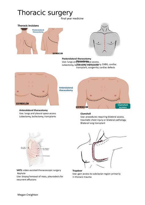 Thoracic surgery - final year medicine Thoracic incisions ...