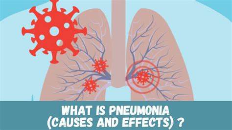 What causes Pneumonia ? - YouTube