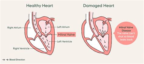 Mitral valve endocardiosis in dogs | ManyPets