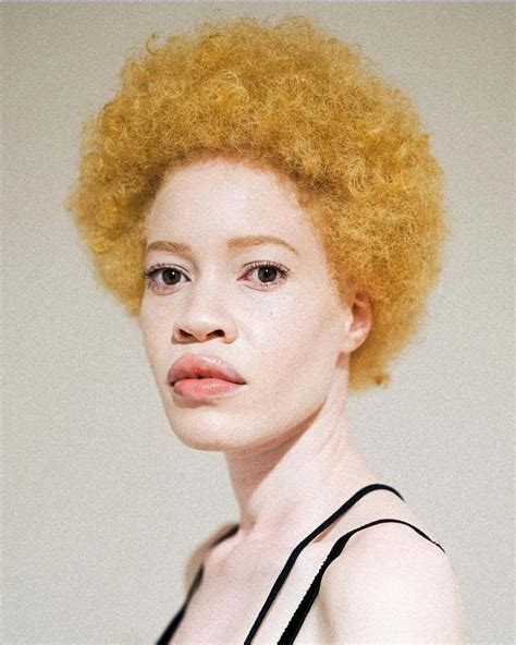 Stunning Model with Albinism Expands the Definition of Beauty