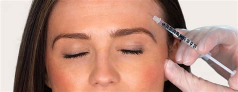 Non-Surgical Brow Lift (Using Cosmetic Injectables): Taking Years Away ...