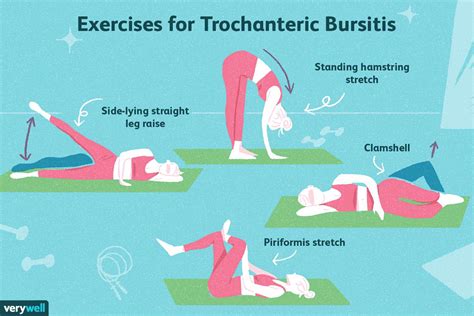 Trochanteric Bursitis Pain Pattern