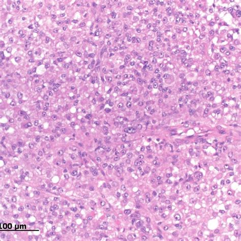 (PDF) Metastasized Leydig cell tumor in a dog