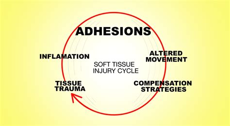 Soft Tissue Therapy - Explained - PreHab Exercises