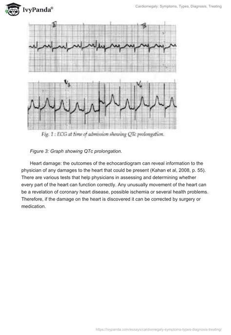 Cardiomegaly: Symptoms, Types, Diagnosis, Treating - 1401 Words | Research Paper Example