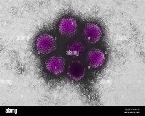 Electron micrograph of canine adenovirus type-1 (CAV-1 Stock Photo ...