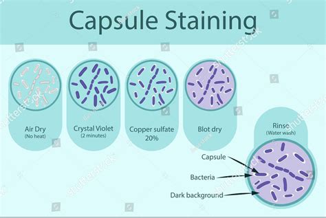 Capsule Staining: Principle, Methods, Procedure and Examples | Biology Ease