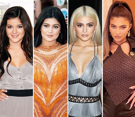 Kardashian-Jenners Plastic Surgery: Before and After Photos