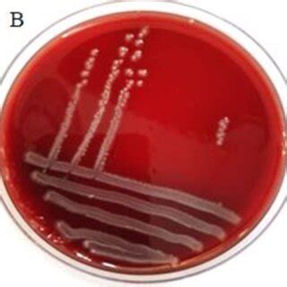 A. Beta hemolysis, B. Gamma hemolysis. | Download Scientific Diagram