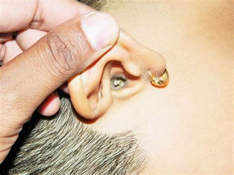 Doctor’s guide on clearing ear wax blockage & cleaning your ears safely ...