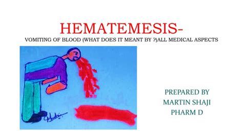 Hematemesis- vomiting of blood , a brief study | PPT