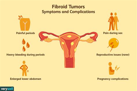 Uterine Fibroid Tumors: Symptoms, Causes, Diagnosis, and Treatment