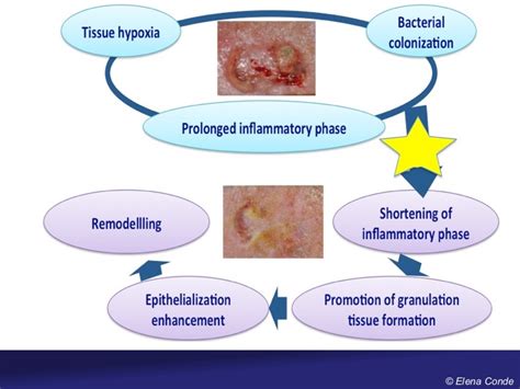 Wound Healing Before And After