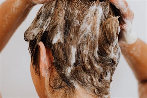 4 signs that you’re suffering from scalp inflammation – and what to do about it – Daily Vanity