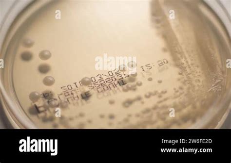 Antibiotic petri dish resistance Stock Videos & Footage - HD and 4K Video Clips - Alamy