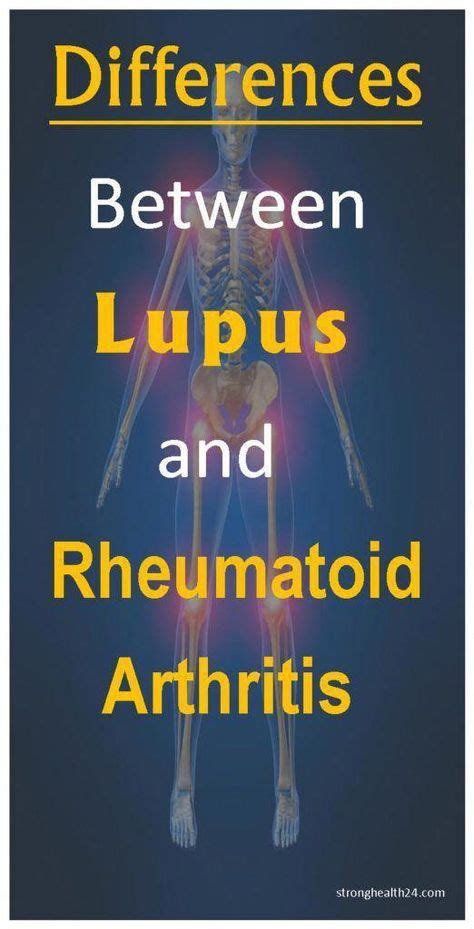 Differences Between Lupus and Rheumatoid Arthritis - stronghealth24 # ...