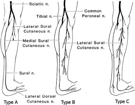 The types of the formation of the sural nerve (SN). Type A: Anastomotic ...