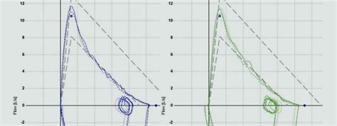 Complete Pulmonary Function Test in New York - Manhattan, NY