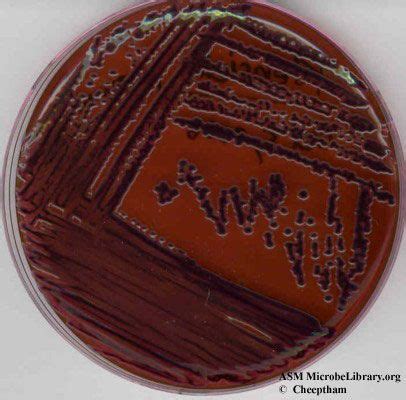 http://www.microbelibrary.org/images/atlas_emb/klebsiella%20pneumoniae_emb_fig3.jpg IG. 3. EMB ...