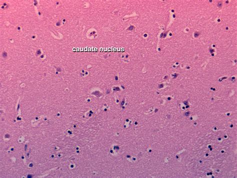 Chapter 1: Normal gross brain and microscopy | Renaissance School of Medicine at Stony Brook ...