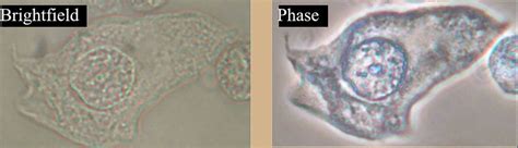 What is Phase contrast?