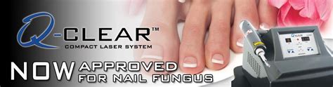 Toenail Fungus - Laser Therapy - Miami & Hialeah Foot Doctor — PerfectFeetCare Podiatry Centers