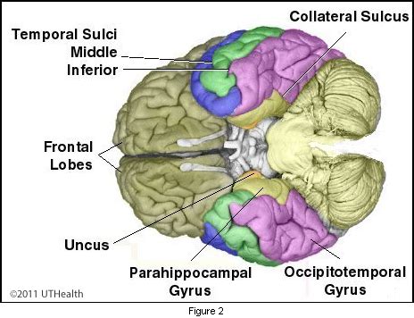 Neuroanatomy Online: Lab 1 - Overview of the Nervous System - Cerebral Lobes - Temporal Lobe ...