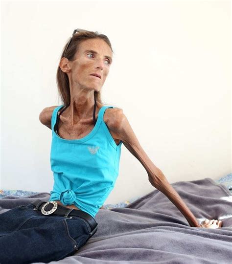 Thinnest woman in the world - 3 impressive stories - Legit.ng