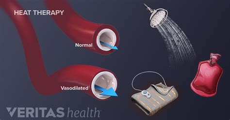 Benefits of Heat Therapy for Lower Back Pain