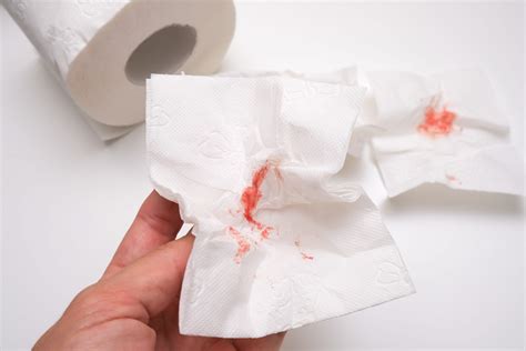 Bleeding GI tract | Singapore| What to do | GUTCARE