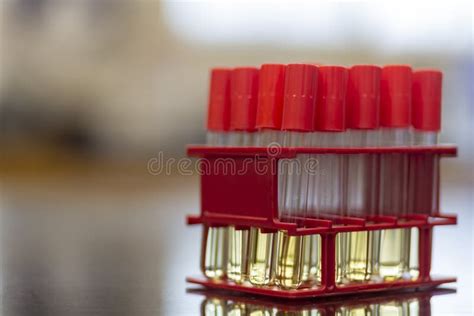 Biochemical Test for Bacteria Identification Stock Image - Image of ...