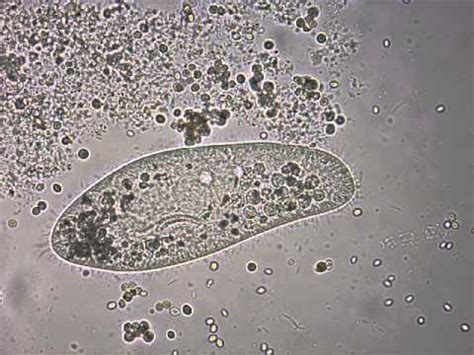 Paramecium Under Microscope 40x