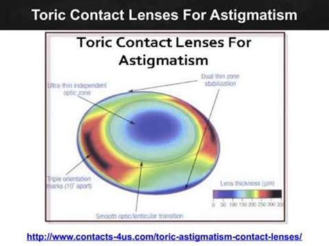 Toric Contact Lenses For Astigmatism - Contacts 4US - YouTube