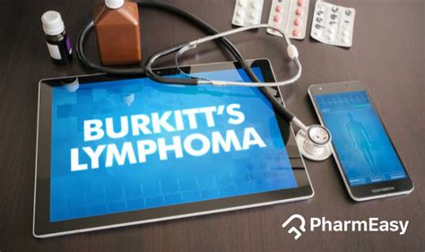 Burkitt Lymphoma: What it is, Symptoms, Causes and Treatment ...