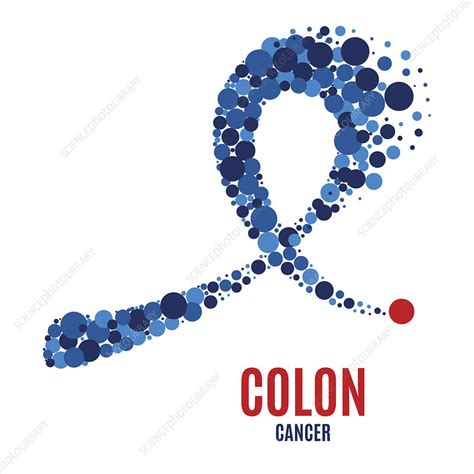 Colon cancer awareness ribbon, illustration - Stock Image - F028/9233 - Science Photo Library