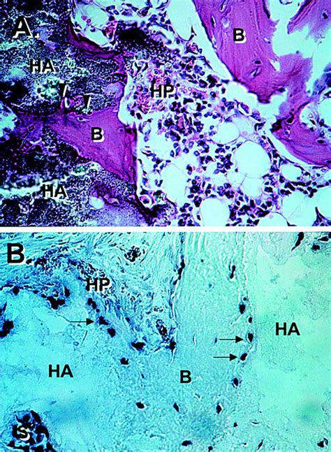 Bone Marrow Stromal Stem Cells: Nature, Biology, and Potential ...